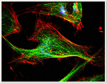 Cell stained with immunofluorescence